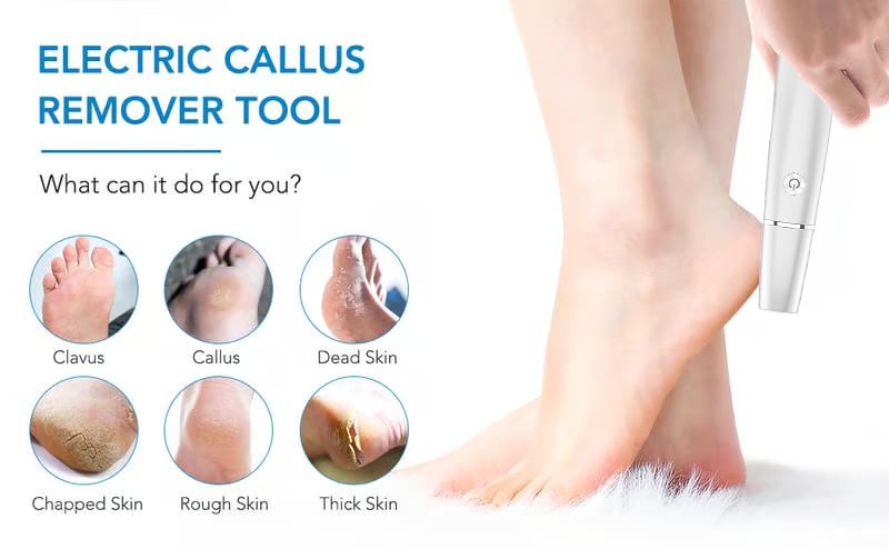 Last Day Electric Feet Callus Remover