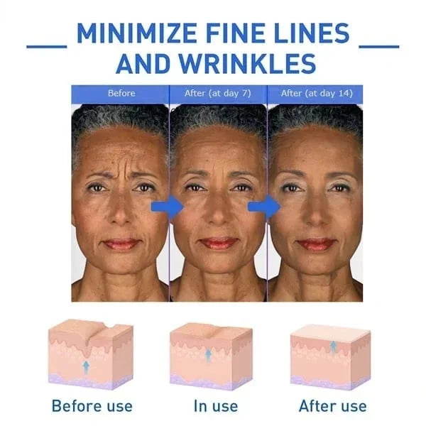 🎉Botox Face Serum🎉