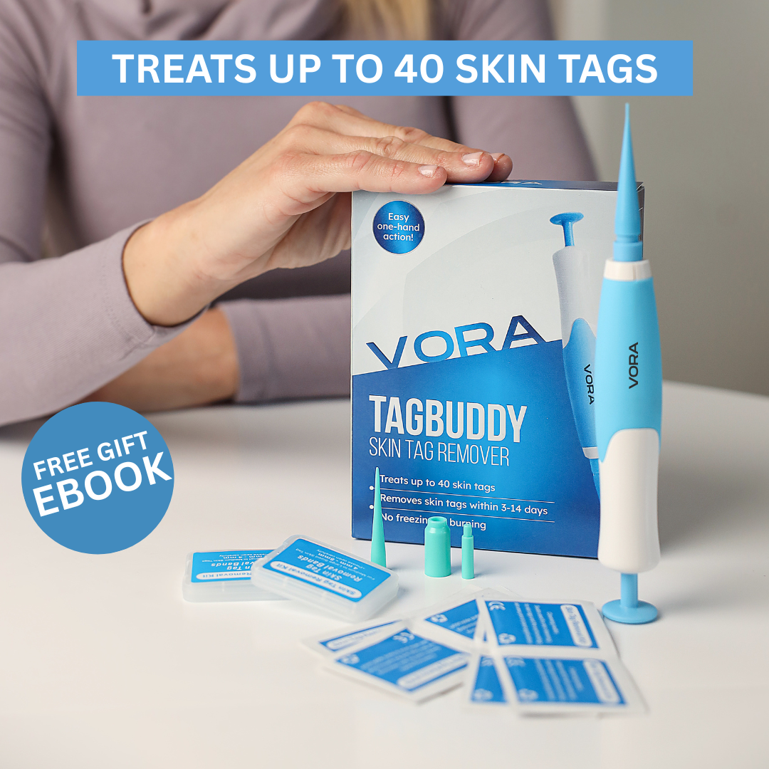 🔥TagBuddy Kit - No More Skin Tags