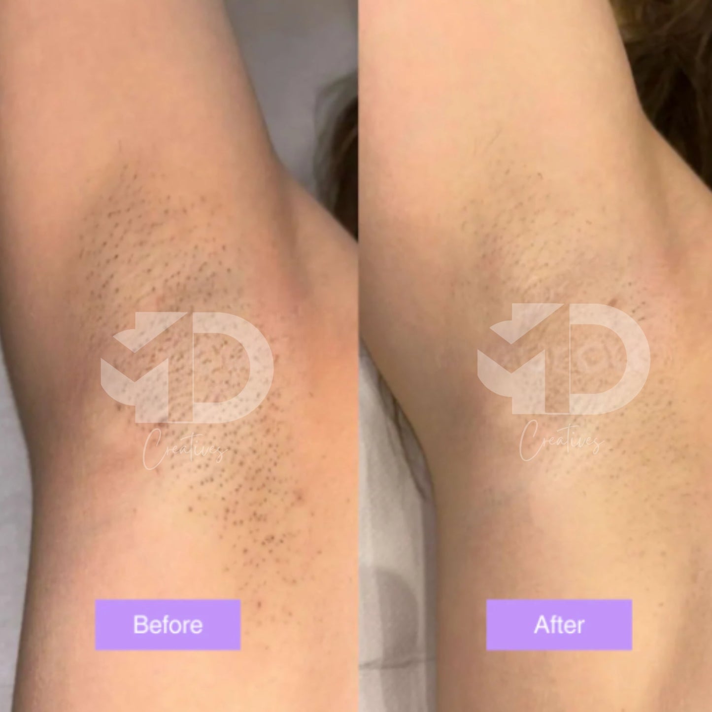 Cyperus Rotundus Skin Serum