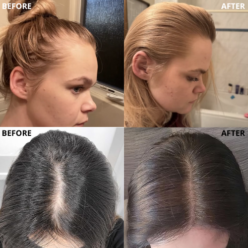 100% Natural Hair Growth Oil