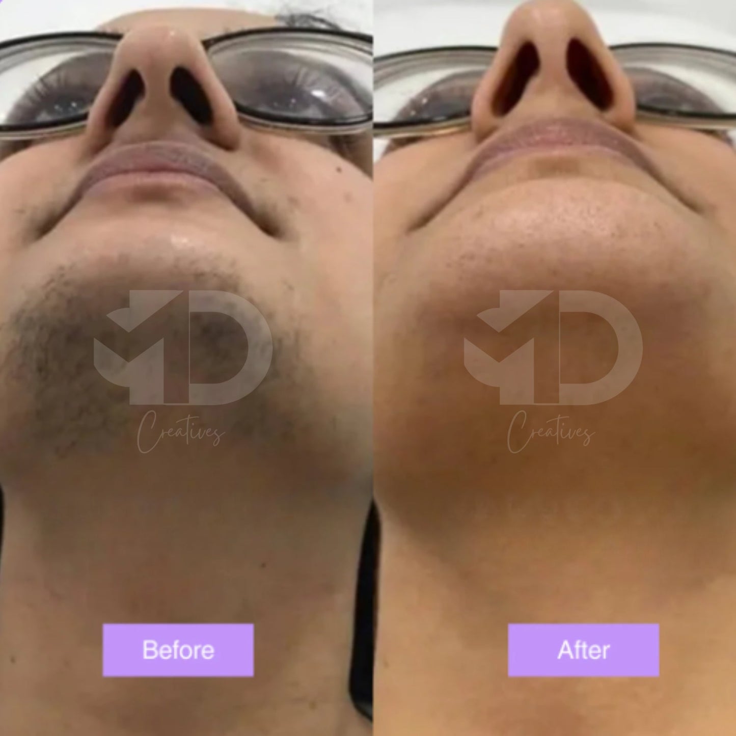 Cyperus Rotundus Skin Serum