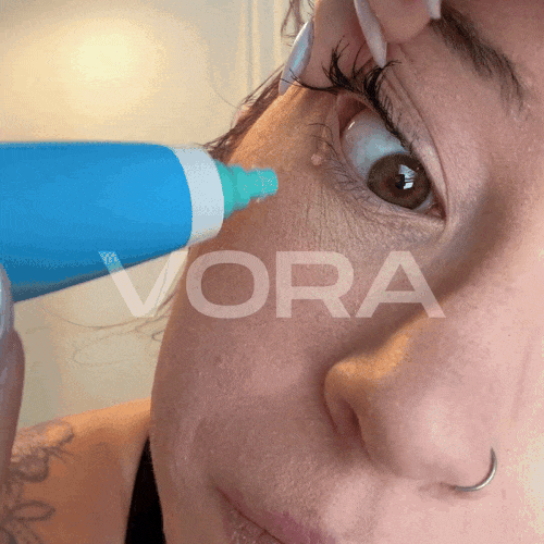🔥TagBuddy Kit - No More Skin Tags