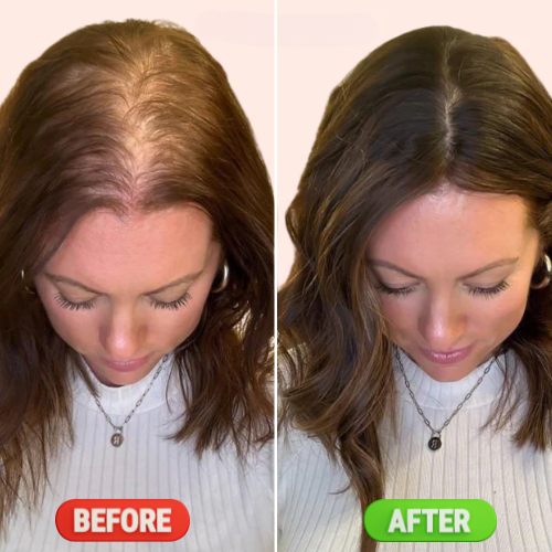 100% Natural Hair Growth Oil