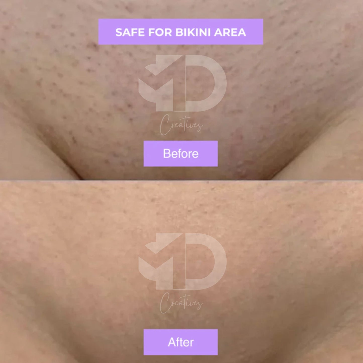 Cyperus Rotundus Skin Serum