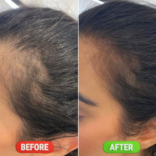 100% Natural Hair Growth Oil