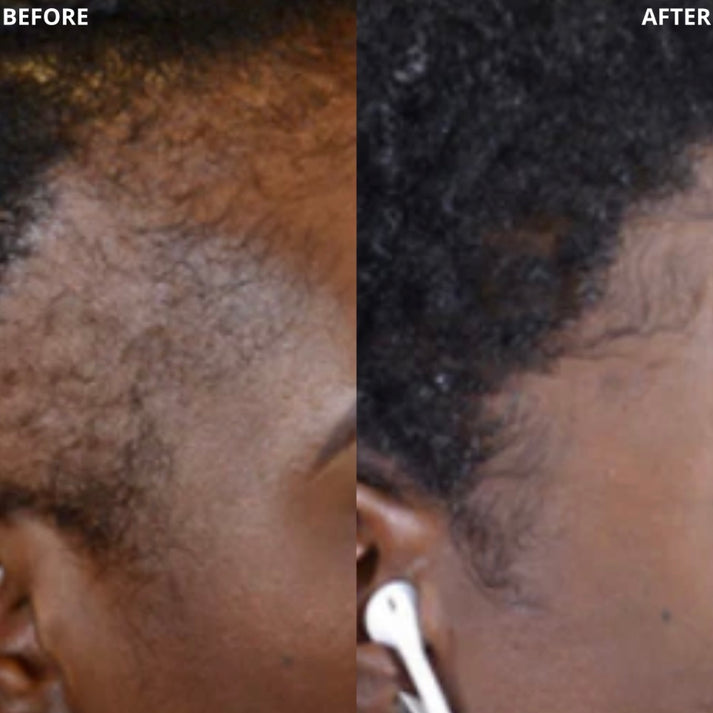 100% Natural Hair Growth Oil
