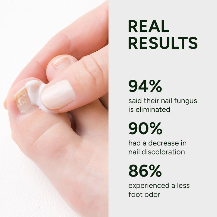 🔥Nail Fungus Treatment Gel