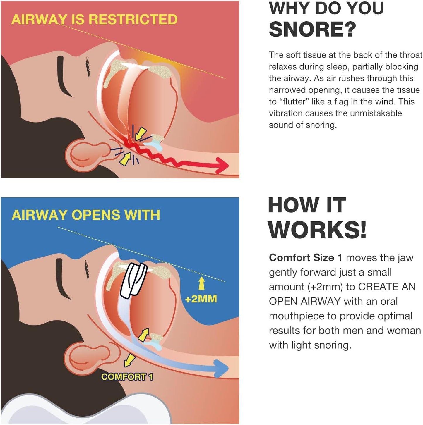 Anti Snoring Bruxism Mouth Guard