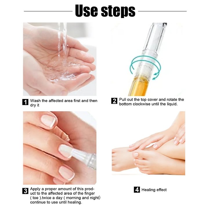 👑Anti-Fungal Pen – Gets Rid Of Even the Most Stubborn Nail Fungus🔥