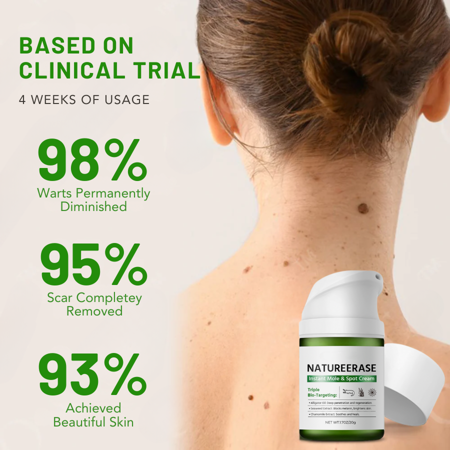 Official Store: NatureErase Instant Mole & Spot Cream