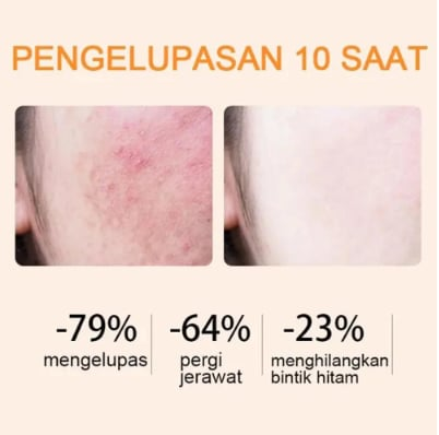 š¤©šOrange Enzyme Exfoliating Gel ā The Gentle Miracle Your Skin Has Been Crying Out Forš„