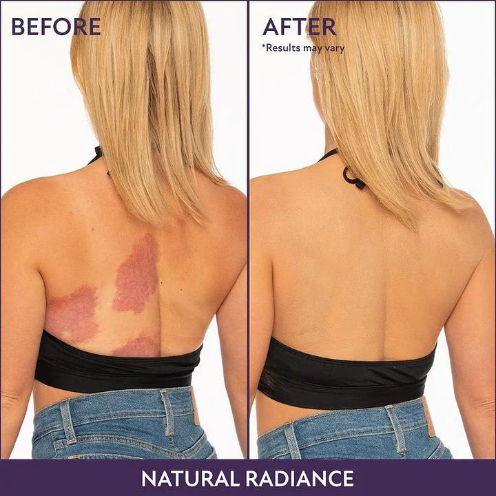 🔥Body Coverage Perfector – Waterproof, lightweight & flawless body makeup