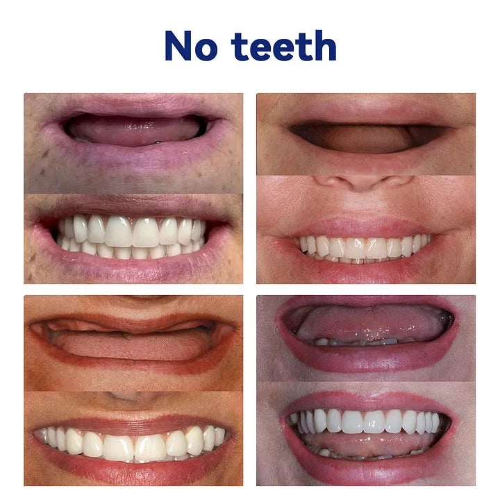 🔥Advanced Customized Full Denture Set