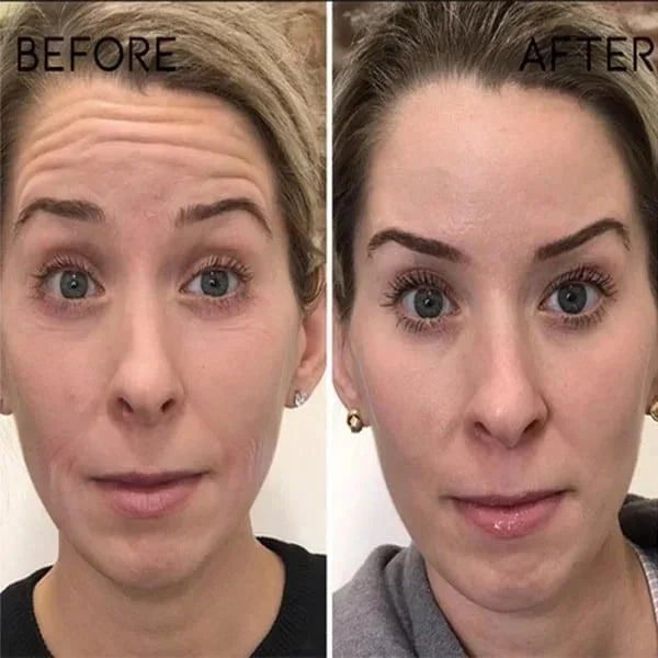 🎉Botox Face Serum🎉