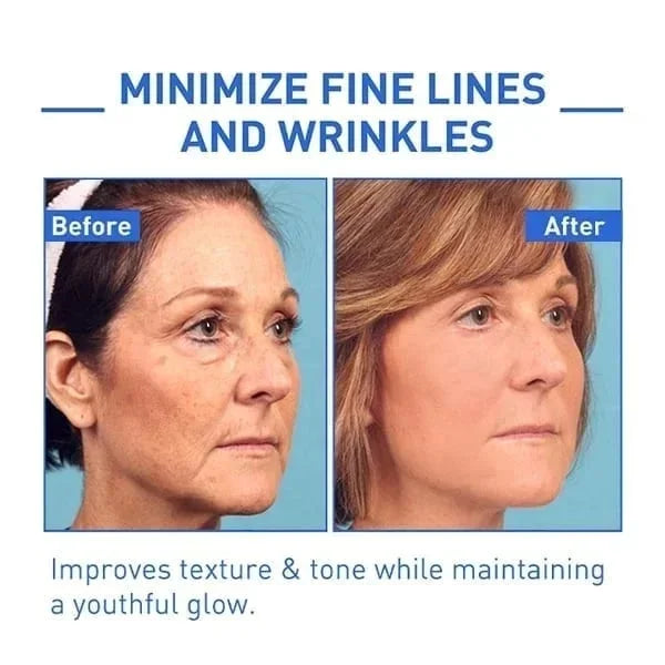 🎉Botox Face Serum🎉