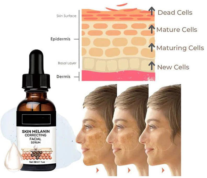 š„Fast Dark Spot Remover-Melanin Correcting Facial Serum
