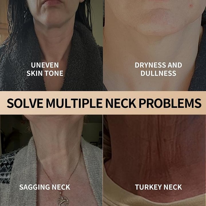 Neck & Eye Care Set – Tighten, Smooth & Hydrate 🔥 All-in-One Moisturizing Treatment for Delicate Skin💧