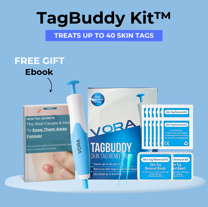 🔥TagBuddy Kit - No More Skin Tags