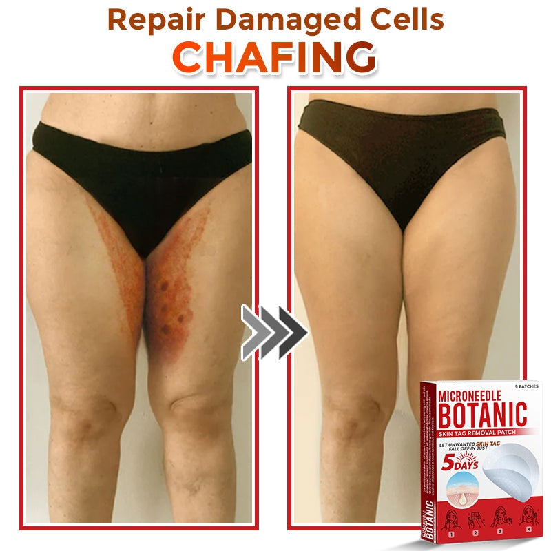 🔥MicroNeedle Botanic Skin Tag Removal Patch 🇺🇸 Made in the USA⏰