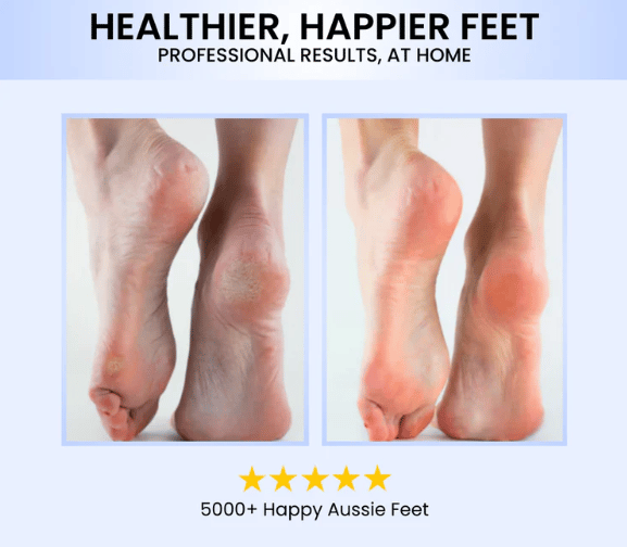 Last Day Electric Feet Callus Remover