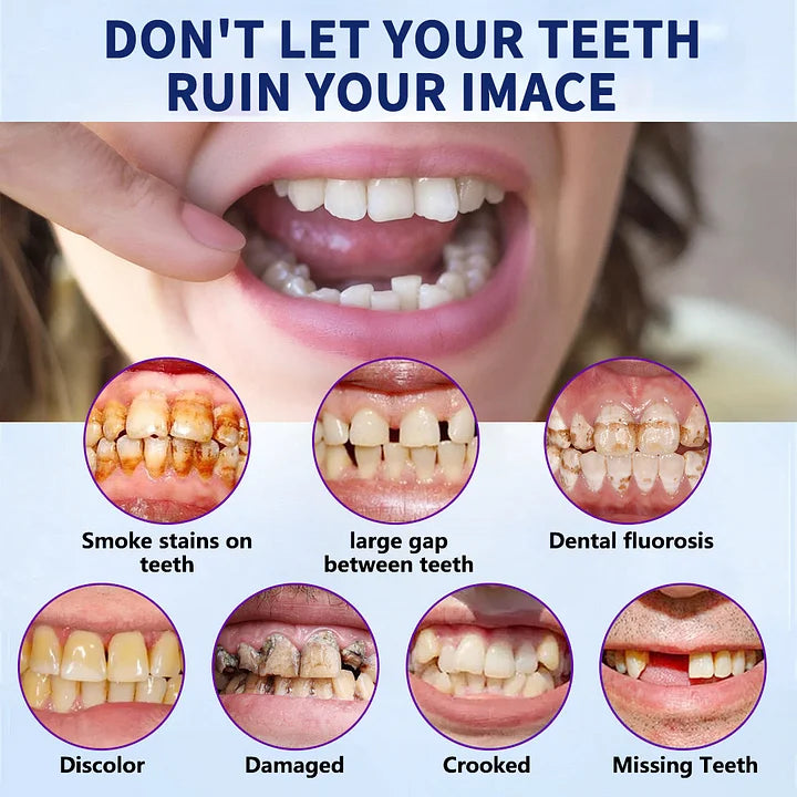 🔥Advanced Customized Full Denture Set