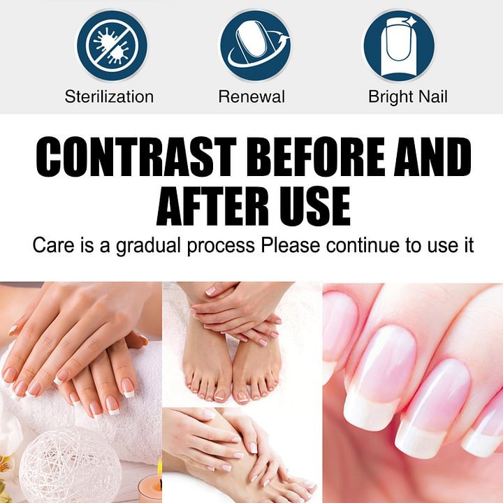 👑Anti-Fungal Pen – Gets Rid Of Even the Most Stubborn Nail Fungus🔥