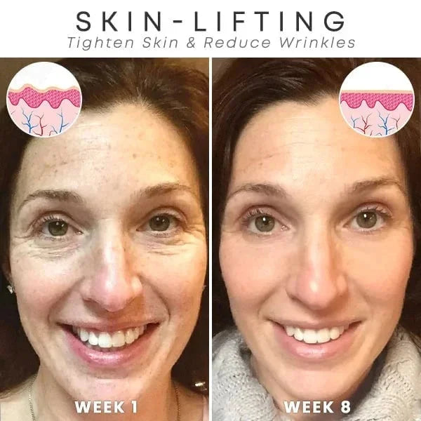 🎉Botox Face Serum🎉