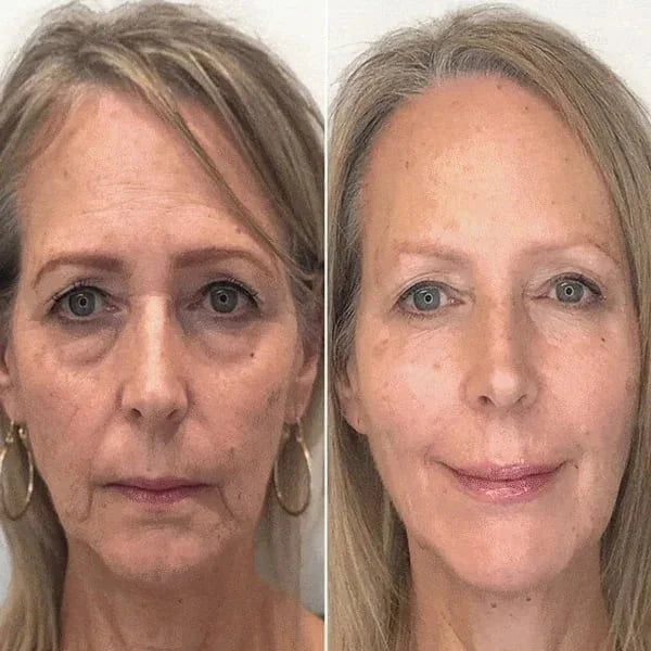 🎉Botox Face Serum🎉