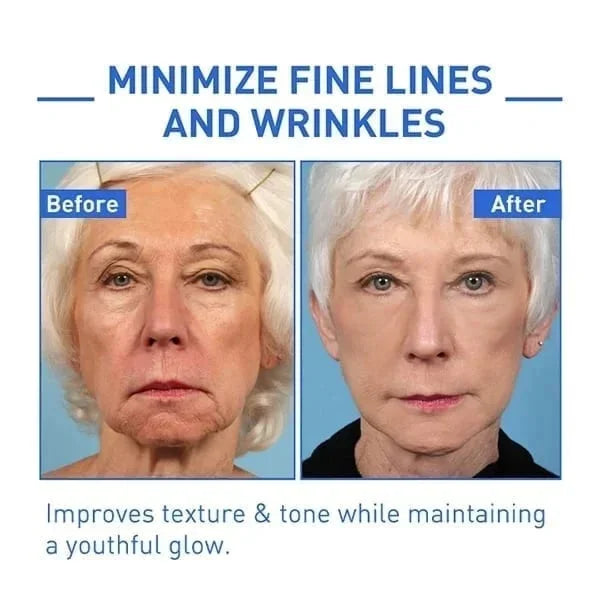 🎉Botox Face Serum🎉