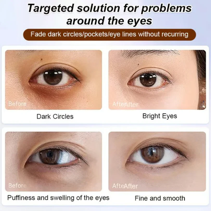 🎁Gentian Anti-Wrinkle Eye Cream🎁