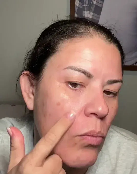 šSilicone Scar Sheets