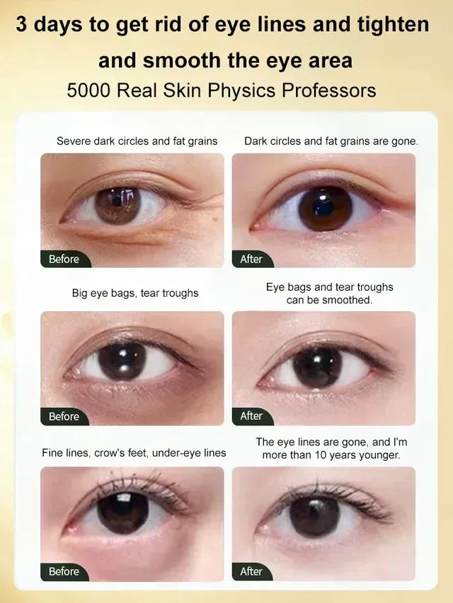 🎁Gentian Anti-Wrinkle Eye Cream🎁