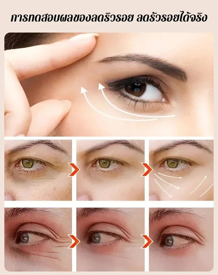 🎁Gentian Anti-Wrinkle Eye Cream🎁