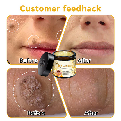🎈Bee Venom Skin Treatment Cream（✅DERMATOLOGIST RECOMMENDED）