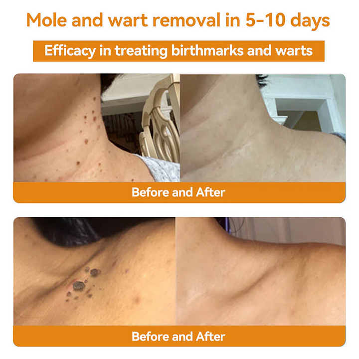 🎈Bee Venom Skin Treatment Cream（✅DERMATOLOGIST RECOMMENDED）