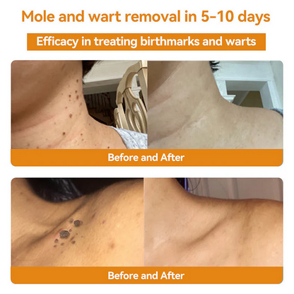 🎈Bee Venom Skin Treatment Cream（✅DERMATOLOGIST RECOMMENDED）
