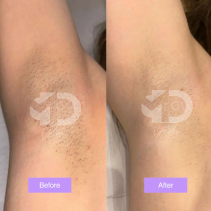 Cyperus Rotundus Skin Serum
