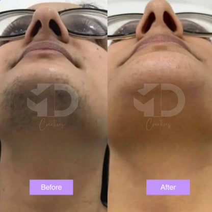 Cyperus Rotundus Skin Serum