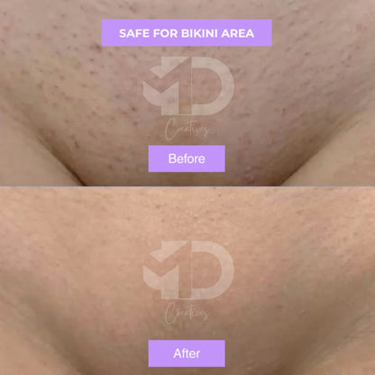 Cyperus Rotundus Skin Serum