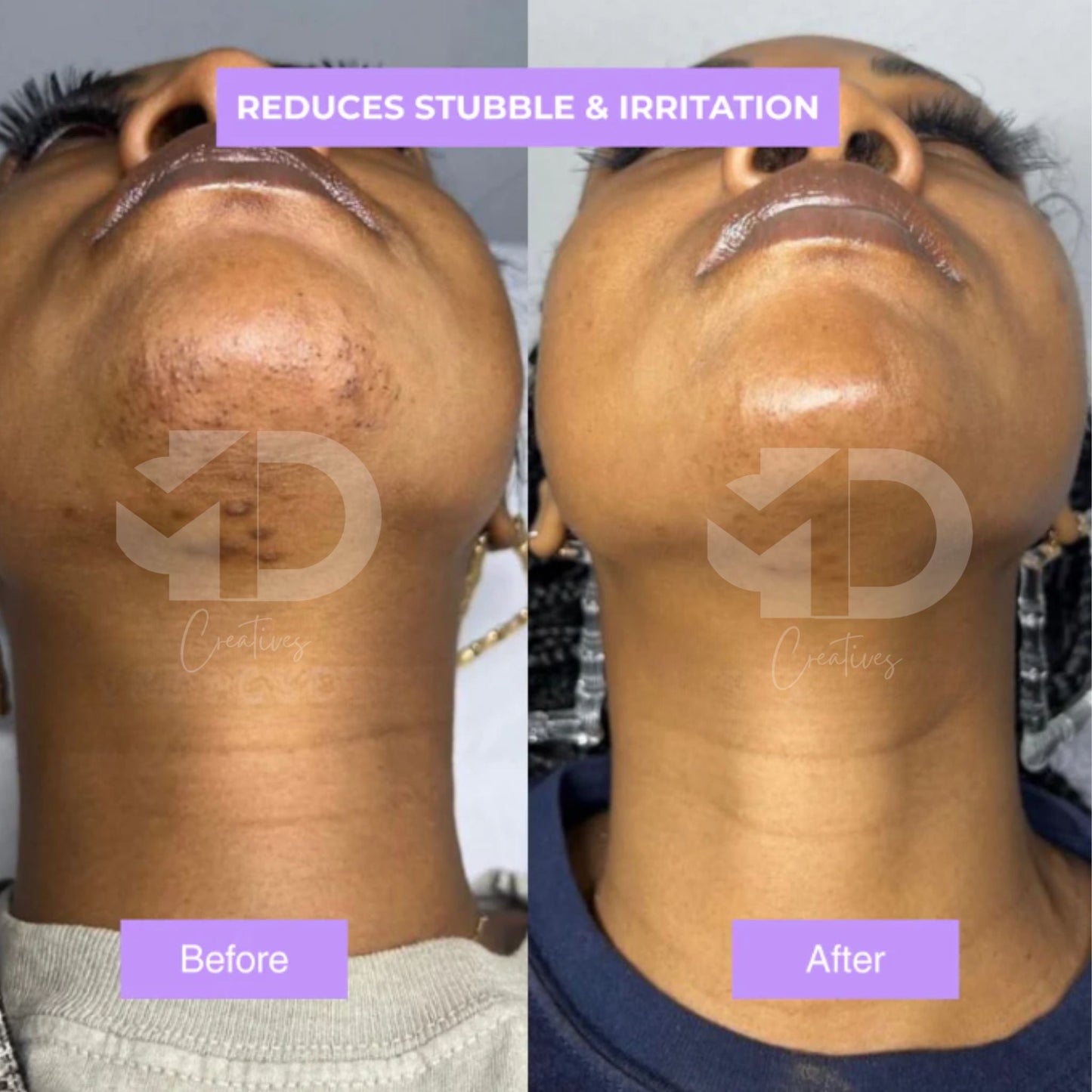 Cyperus Rotundus Skin Serum
