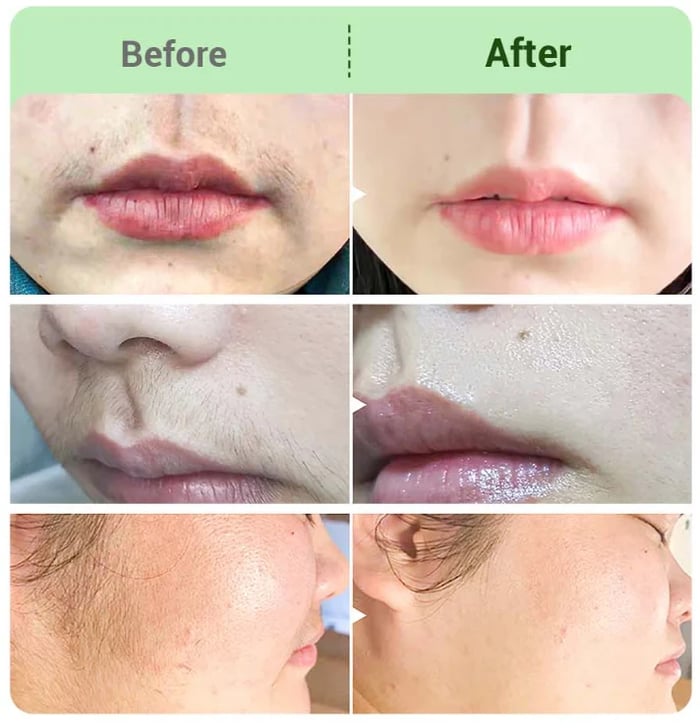 🔥BUY 2 GET 1 FREE🤩Hair Removal Cream Kit for Women🤩