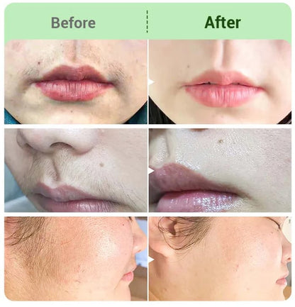 🔥BUY 2 GET 1 FREE🤩Hair Removal Cream Kit for Women🤩