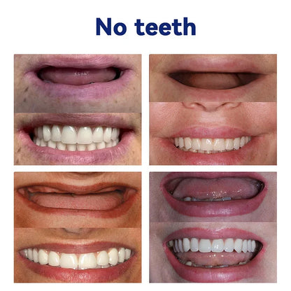 🎁Advanced Customized Full Denture Set🎁