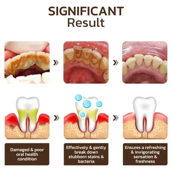 🎁2025 HOT SALE🎁 SP-6 Probiotic Whitening Toothpaste