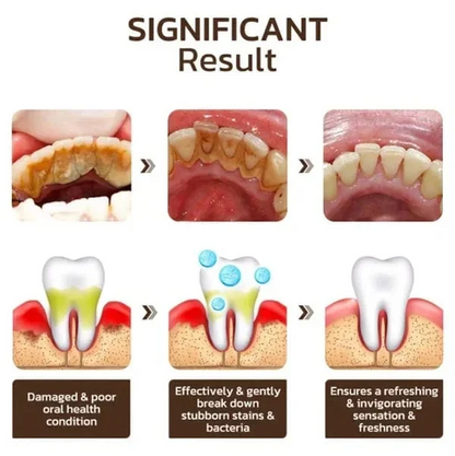 🎁2025 HOT SALE🎁 SP-6 Probiotic Whitening Toothpaste