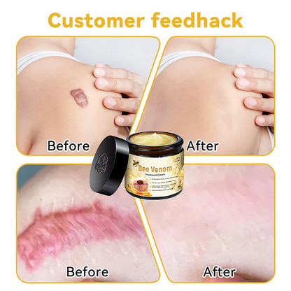 🎈Bee Venom Skin Treatment Cream（✅DERMATOLOGIST RECOMMENDED）