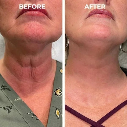 🎉Botox Face Serum🎉