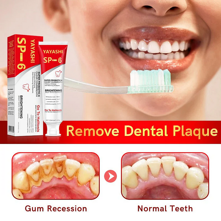 🎁2025 HOT SALE🎁 SP-6 Probiotic Whitening Toothpaste