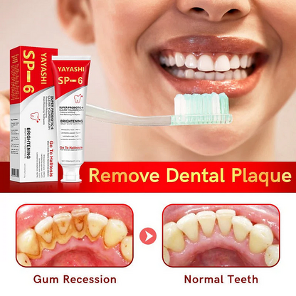 🎁2025 HOT SALE🎁 SP-6 Probiotic Whitening Toothpaste